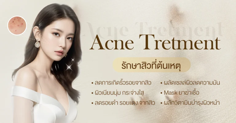 รักษาสิว (Acne Tretment)