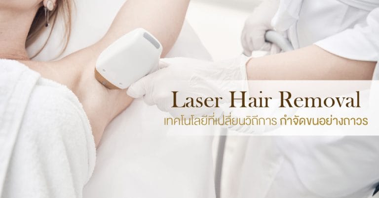 นวัตกรรมเลเซอร์กำจัดขน