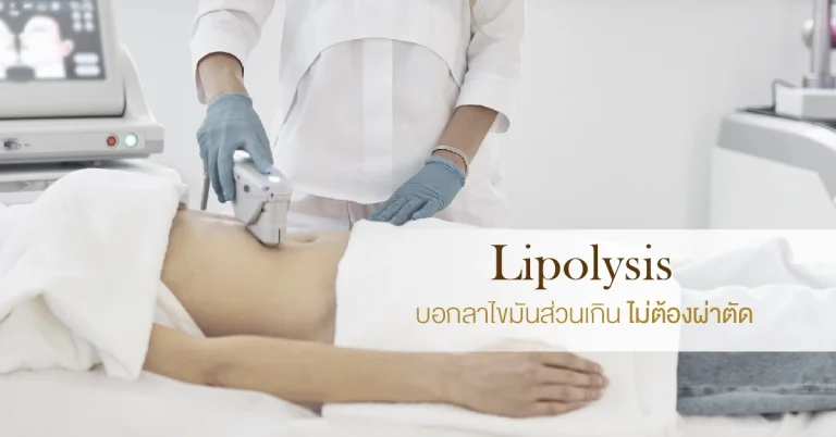 นวัตกรรมสลายไขมัน (Lipolysis)