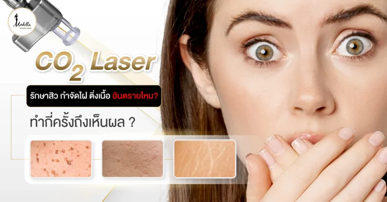 CO2 Laser รักษาสิว กำจัดไฝ ติ่งเนื้อ อันตรายไหม? ทำกี่ครั้งถึงเห็นผล ?