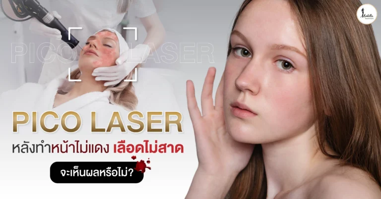 Pico Laser หลังทำหน้าไม่แดง เลือดไม่สาด จะเห็นผลหรือไม่?