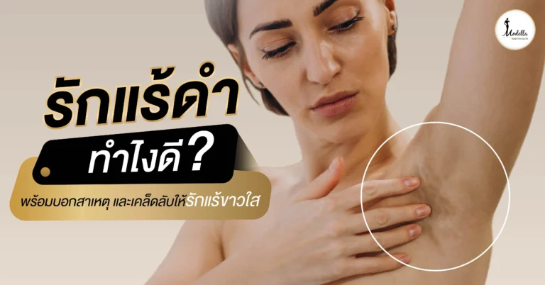รักแร้ดำทำไงดี? พร้อมบอกสาเหตุและเคล็ดลับให้รักแร้ขาวใส