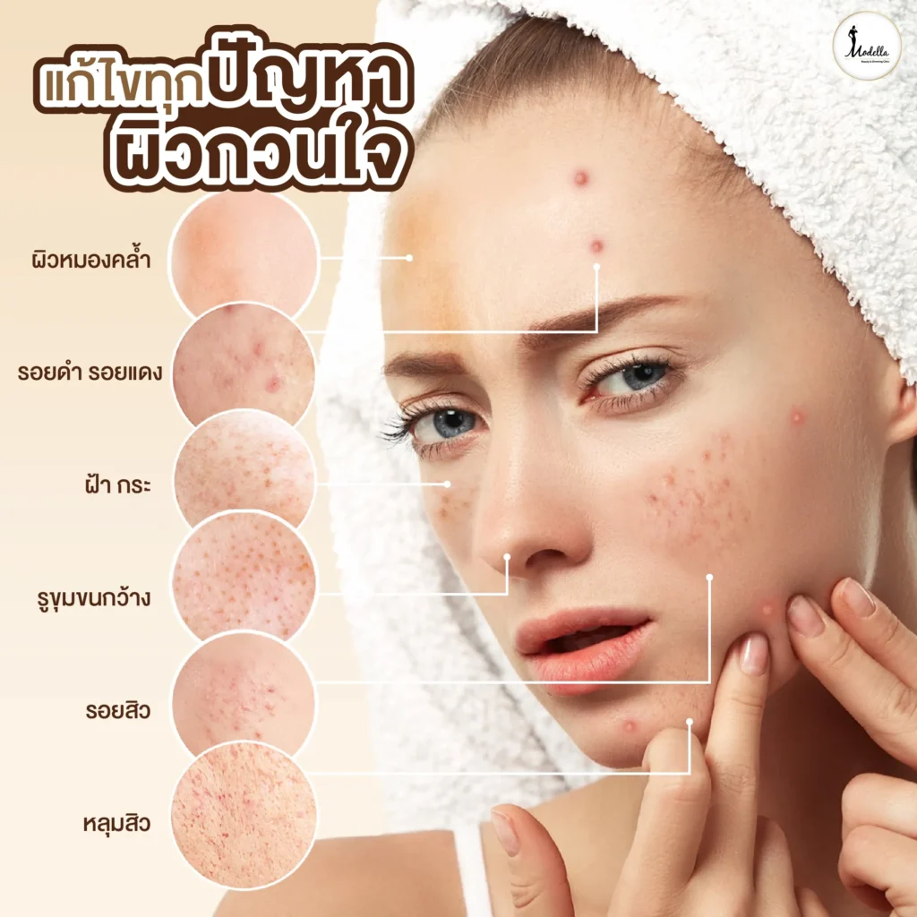 modella_problem_skin