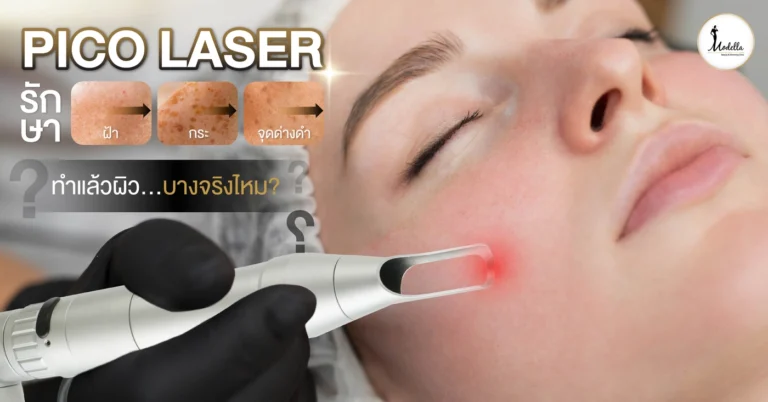 Pico Laser รักษา ฝ้า กระ จุดด่างดำ ทำแล้วผิวบางจริงไหม?