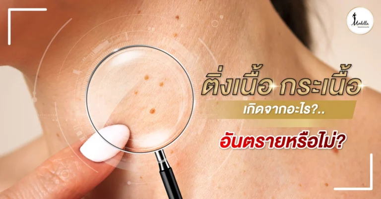 ติ่งเนื้อ กระเนื้อ เกิดจากอะไร ? อันตรายหรือไม่ ?