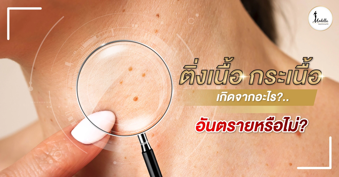 ติ่งเนื้อ กระเนื้อ เกิดจากอะไร ? อันตรายหรือไม่ ?