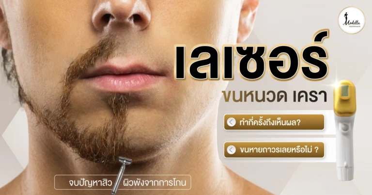 เลเซอร์ขนหนวด เครา ทำกี่ครั้งถึงเห็นผล? ขนหายถาวรเลยหรือไม่ ?