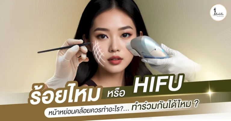 ร้อยไหม หรือ Hifu หน้าหย่อนคล้อยควรทำอะไร ? ทำร่วมกันได้ไหม ?