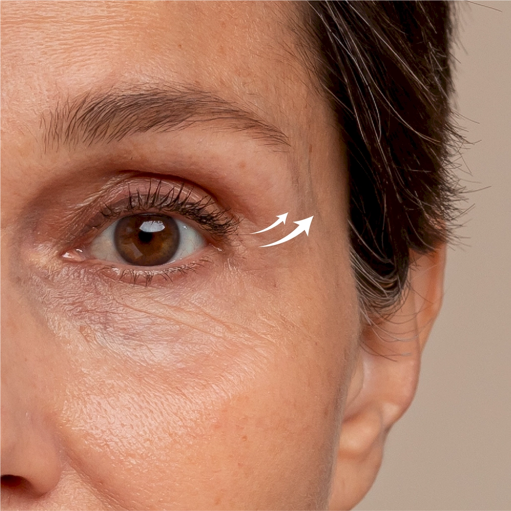 Veeline Smart Laser img2