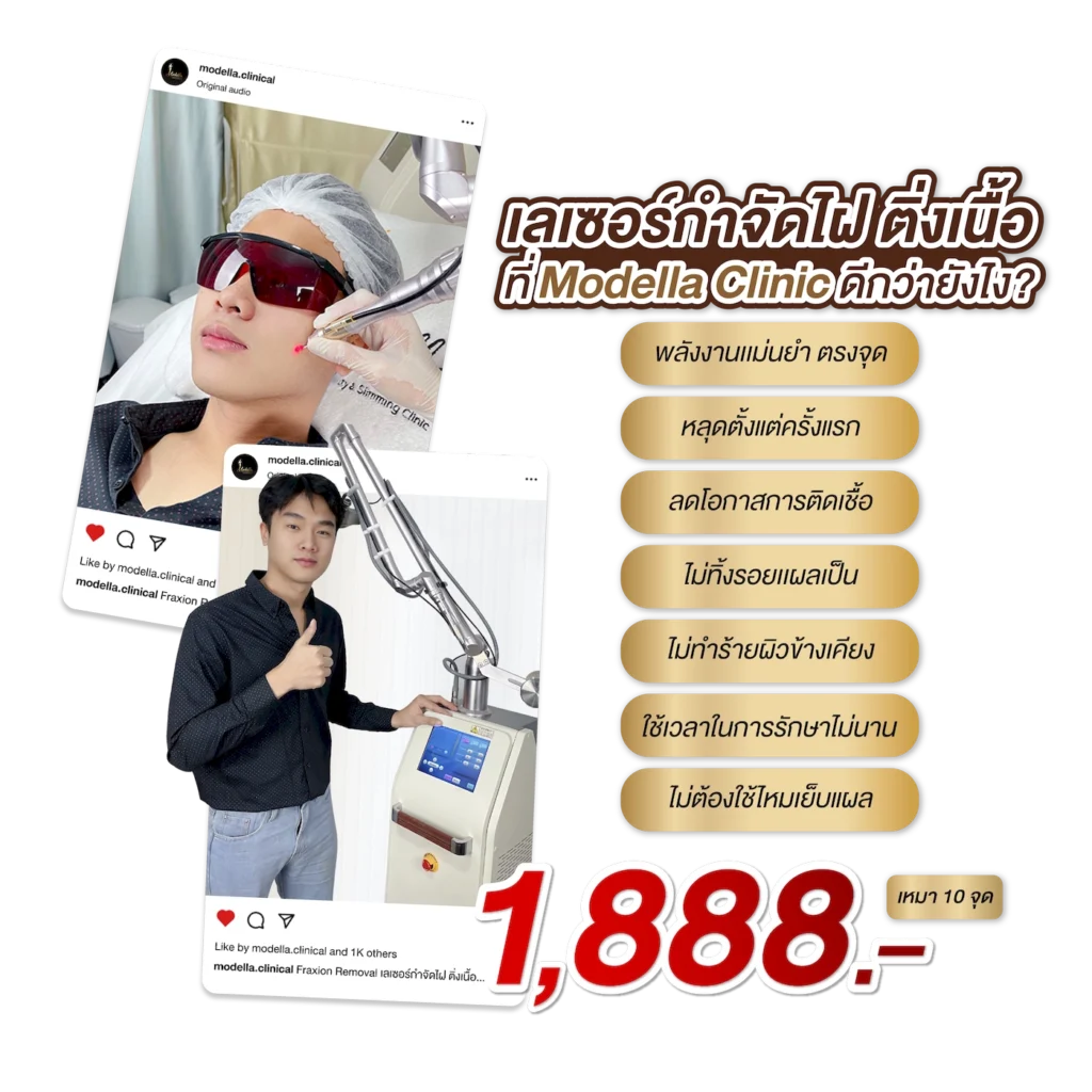 Fraxion Removal_1888_img_10จุด