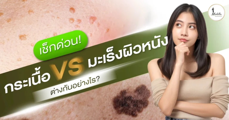 เช็กด่วน! กระเนื้อ หรือ มะเร็งผิวหนังเมลาโนมา ต่างกันยังไง?