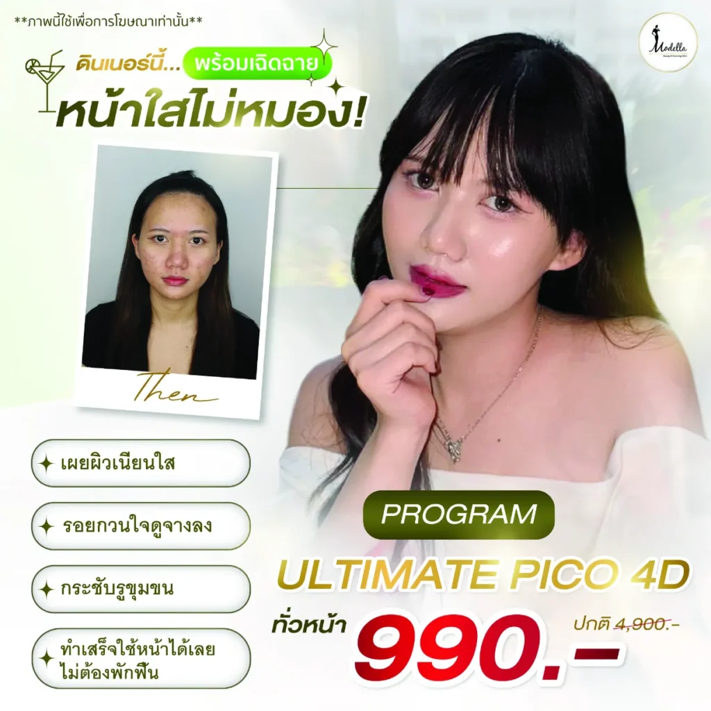 เลเซอร์หน้าใส Ultimate Pico 4D