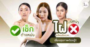 เช็กตำแหน่ง ไฝบนหน้า จุดไหนขัดดวง เสี่ยงสุขภาพต้องรู้!!