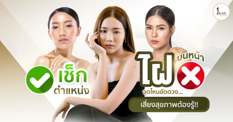 เช็กตำแหน่ง ไฝบนหน้า จุดไหนขัดดวง เสี่ยงสุขภาพต้องรู้!!