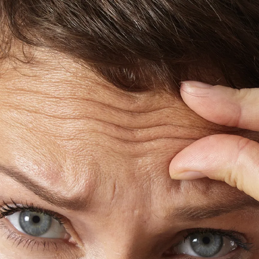 ริ้วรอยหน้าผาก