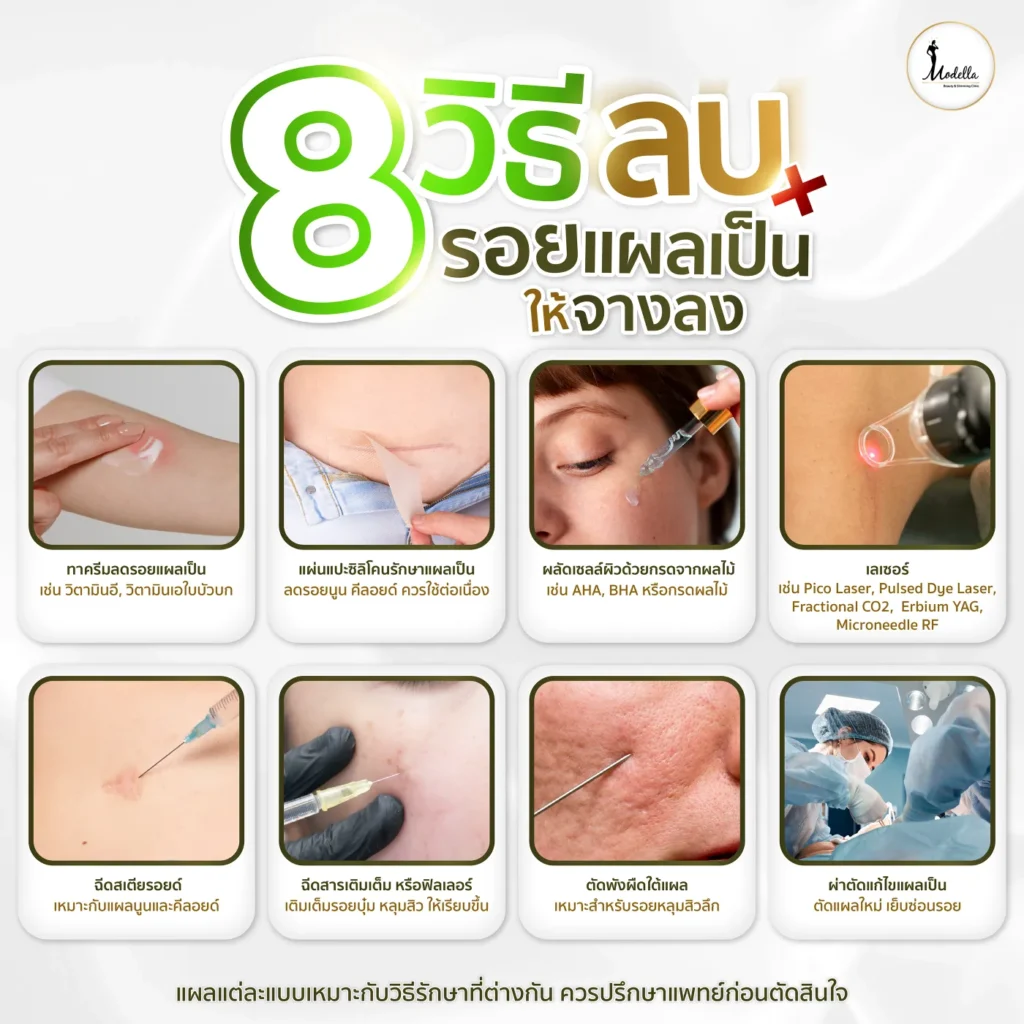 8 วิธีลบรอยแผลเป็นให้จางลง