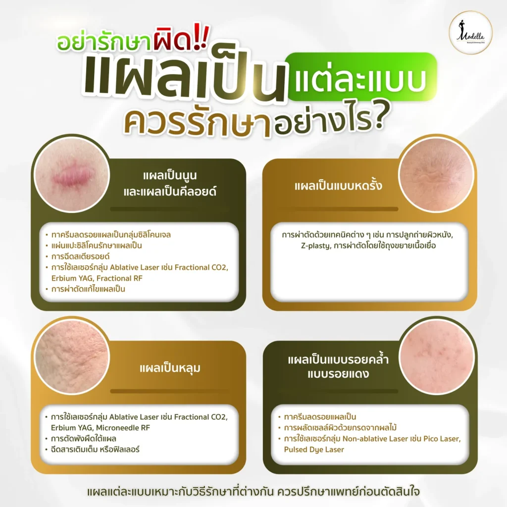 รอยแผลเป็น แต่ละแบบ ควรรักษาอย่างไร?