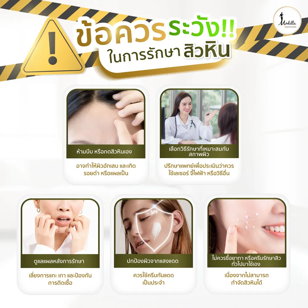 ข้อควรระวัง!!ในการรักษาสิวหิน