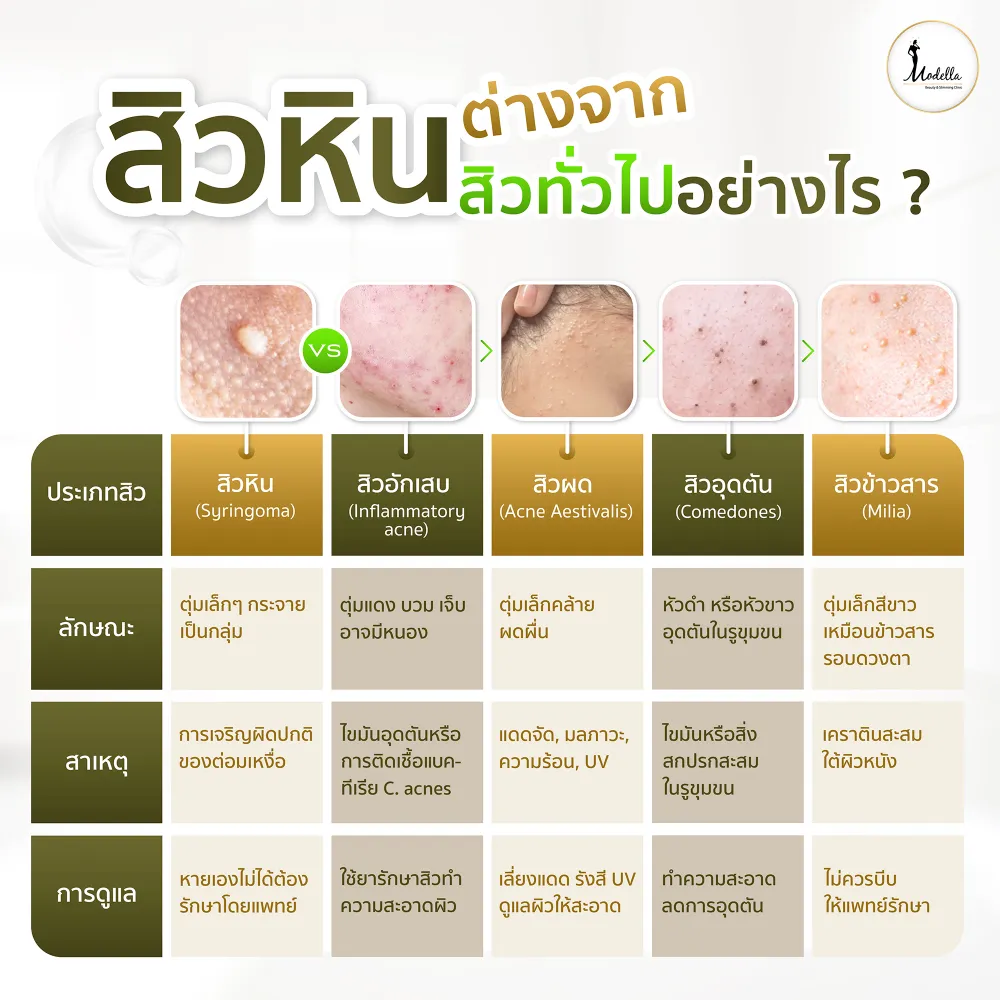 สิวหินต่างจากสิวทั่วไปอย่างไร