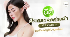 ฉีดฝ้า กระ จุดด่างดำ กี่วันเห็นผล? ผลลัพธ์อยู่ได้นานหรือไม่