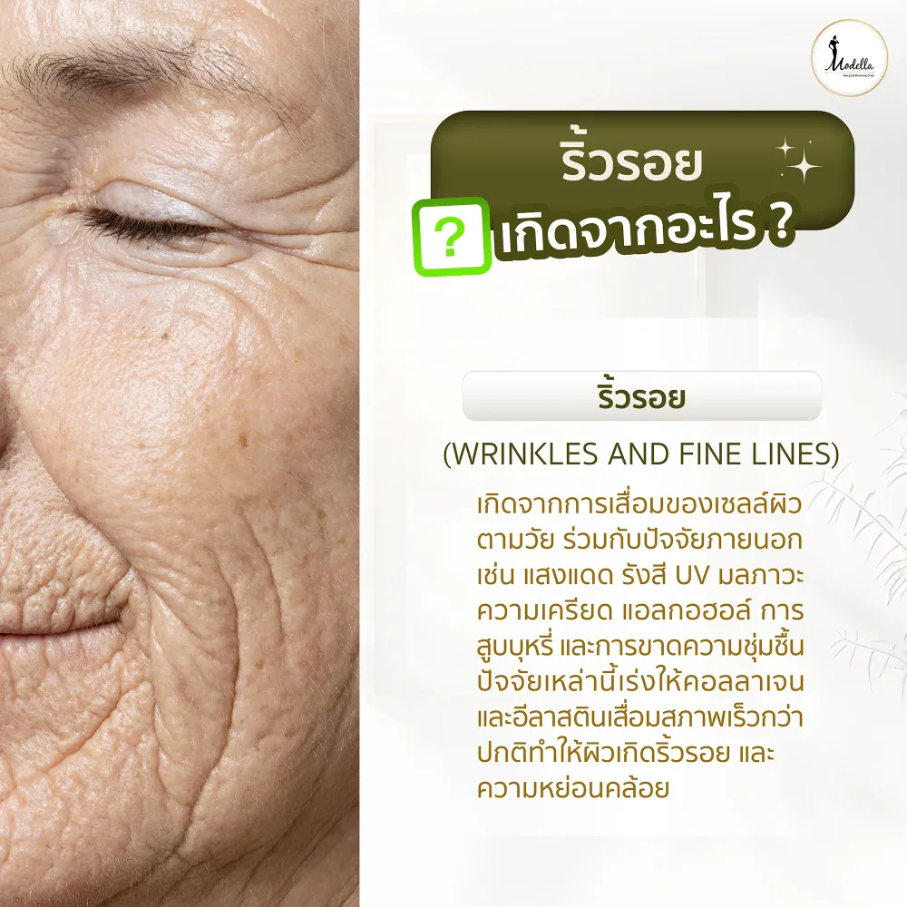 ริ้วรอย เกิดจากอะไร ?