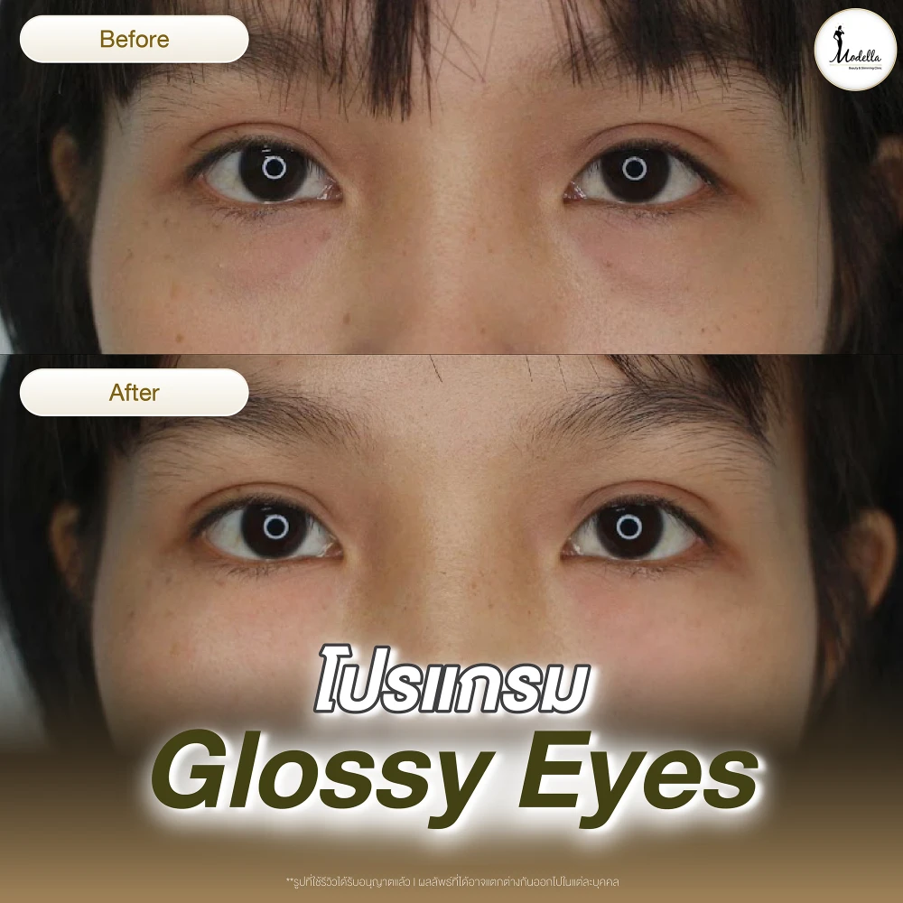 รีวิว โปรแกรม Glossy Eyes