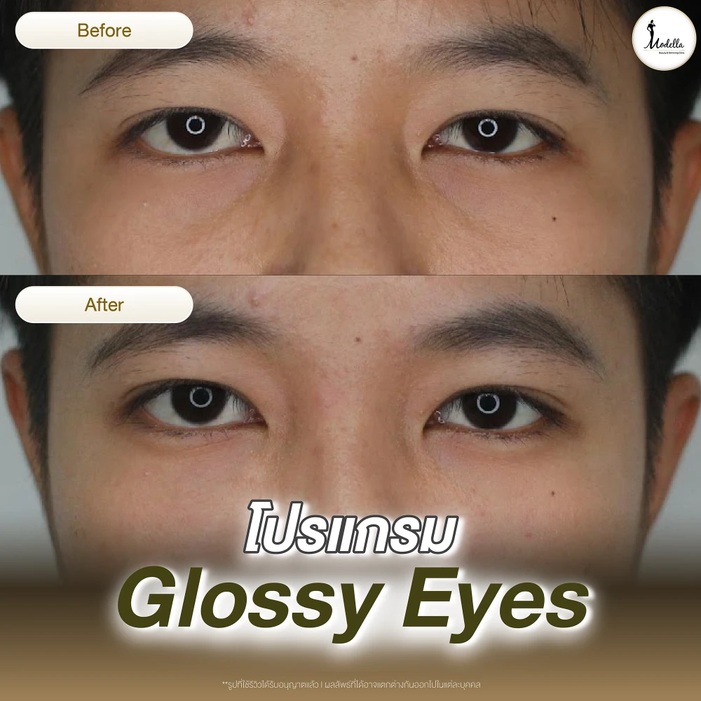 รีวิว โปรแกรม Glossy Eyes
