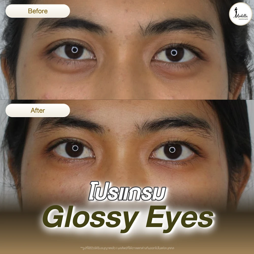 รีวิว โปรแกรม Glossy Eyes