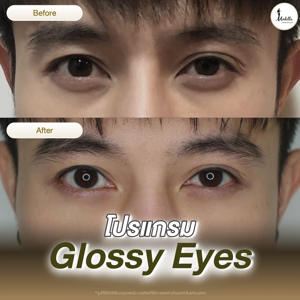 รีวิว โปรแกรม Glossy Eyes