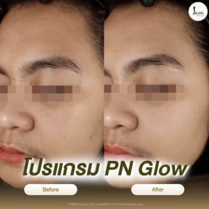 รีวิวโปรแกรม PN Glow