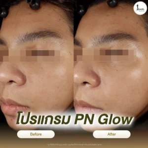 รีวิวโปรแกรม PN Glow