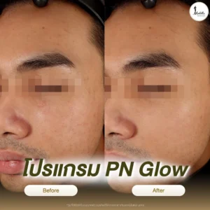 รีวิวโปรแกรม PN Glow