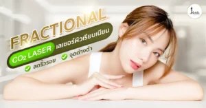 Fractional CO2 Laser เลเซอร์ผิวเรียบเนียน ลดริ้วรอย จุดด่างดำ