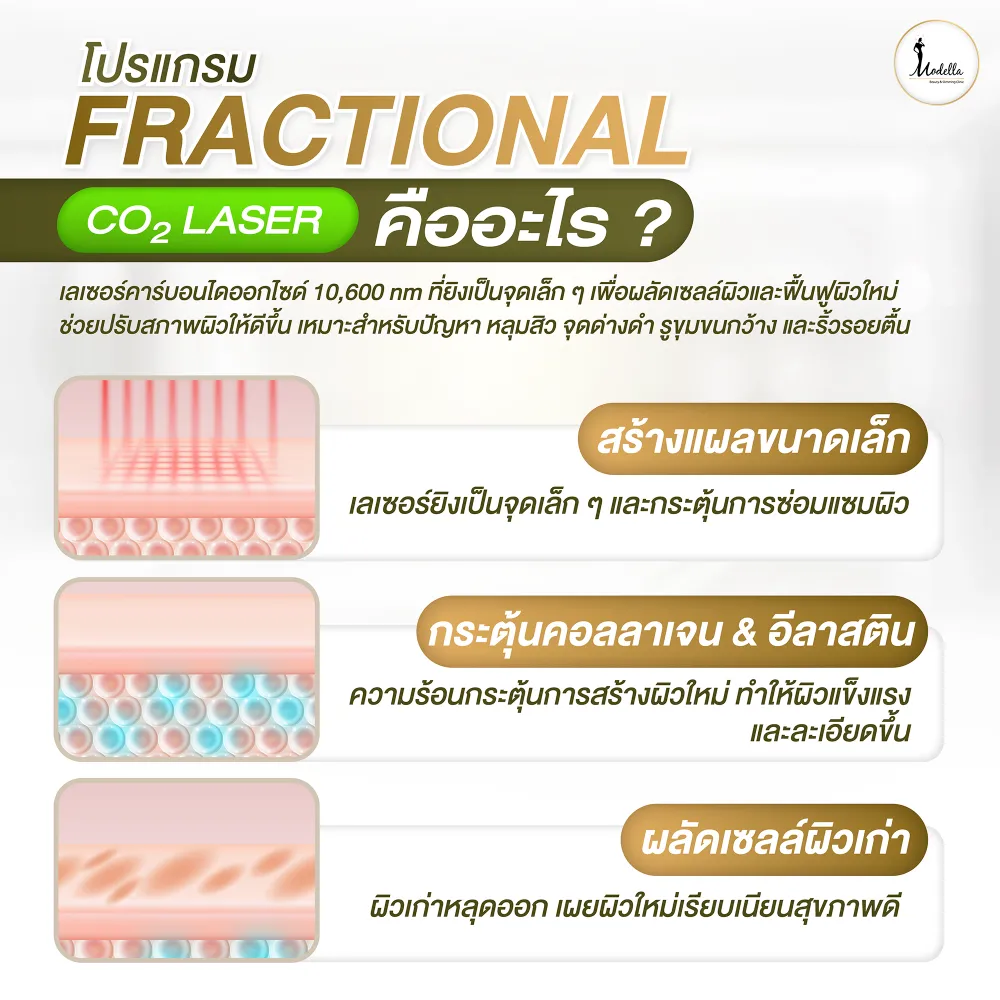 โปรแกรมFractional CO2 Laser คืออะไร ?