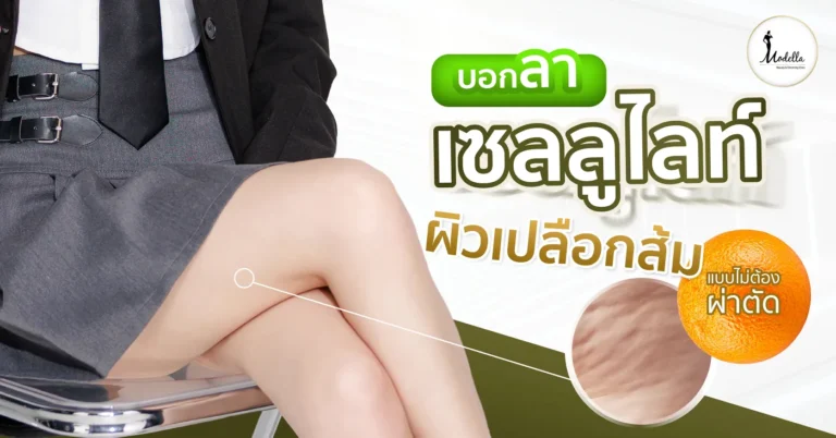บอกลาเซลลูไลท์ ผิวเปลือกส้ม แบบไม่ต้องผ่าตัด