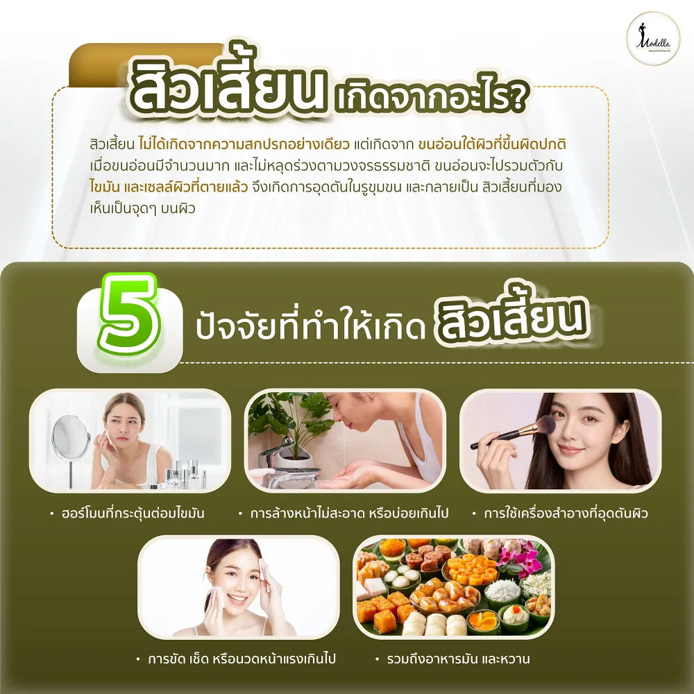 สิวเสี้ยน เกิดจากสาเหตุใด?