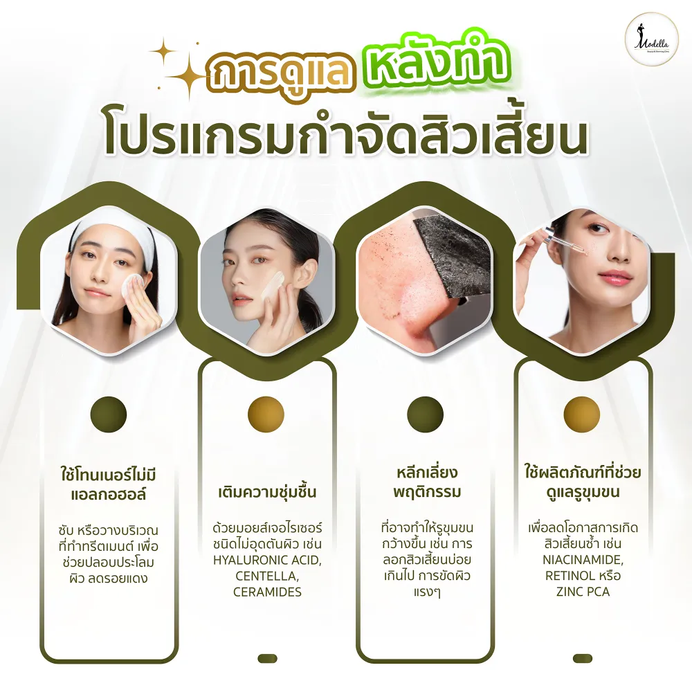 การดูแลหลังทำโปรแกรมกำจัดสิวเสี้ยน