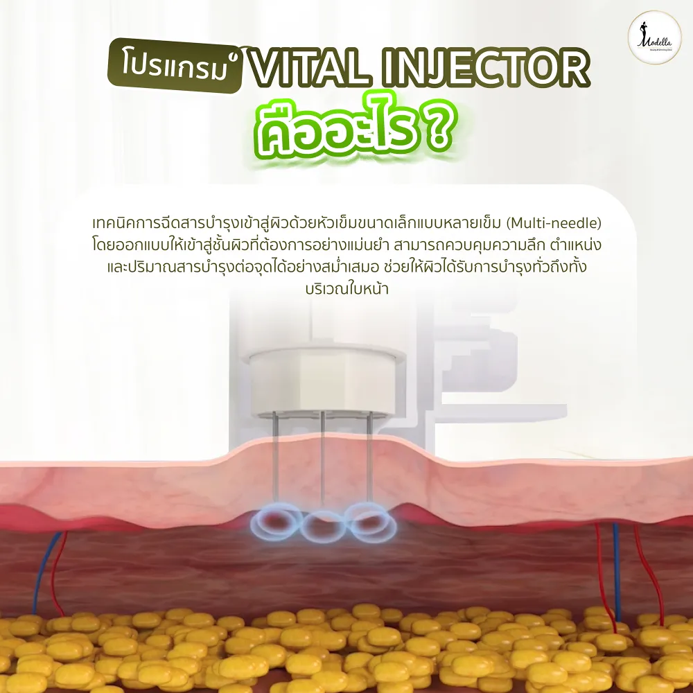 โปรแกรม Vital Injector คืออะไร?