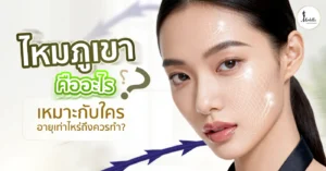 ไหมภูเขา คืออะไร? เหมาะกับใคร? อายุเท่าไหร่ถึงควรทำ?