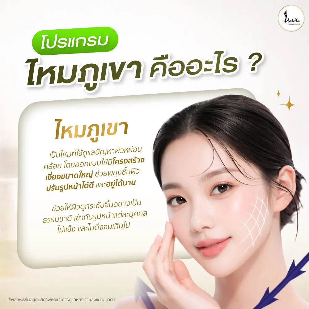 ไหมภูเขา คืออะไร ?