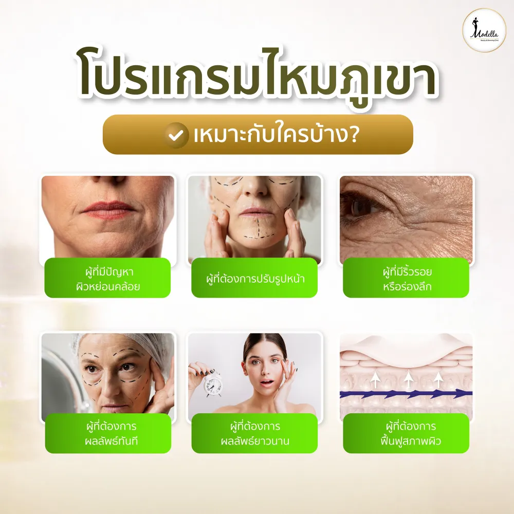 โปรแกรมไหมภูเขา เหมาะกับใครบ้าง? 