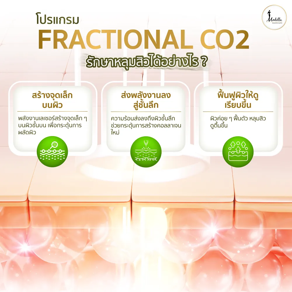 โปรแกรม Fractional CO2 รักษาหลุมสิวได้อย่างไร?