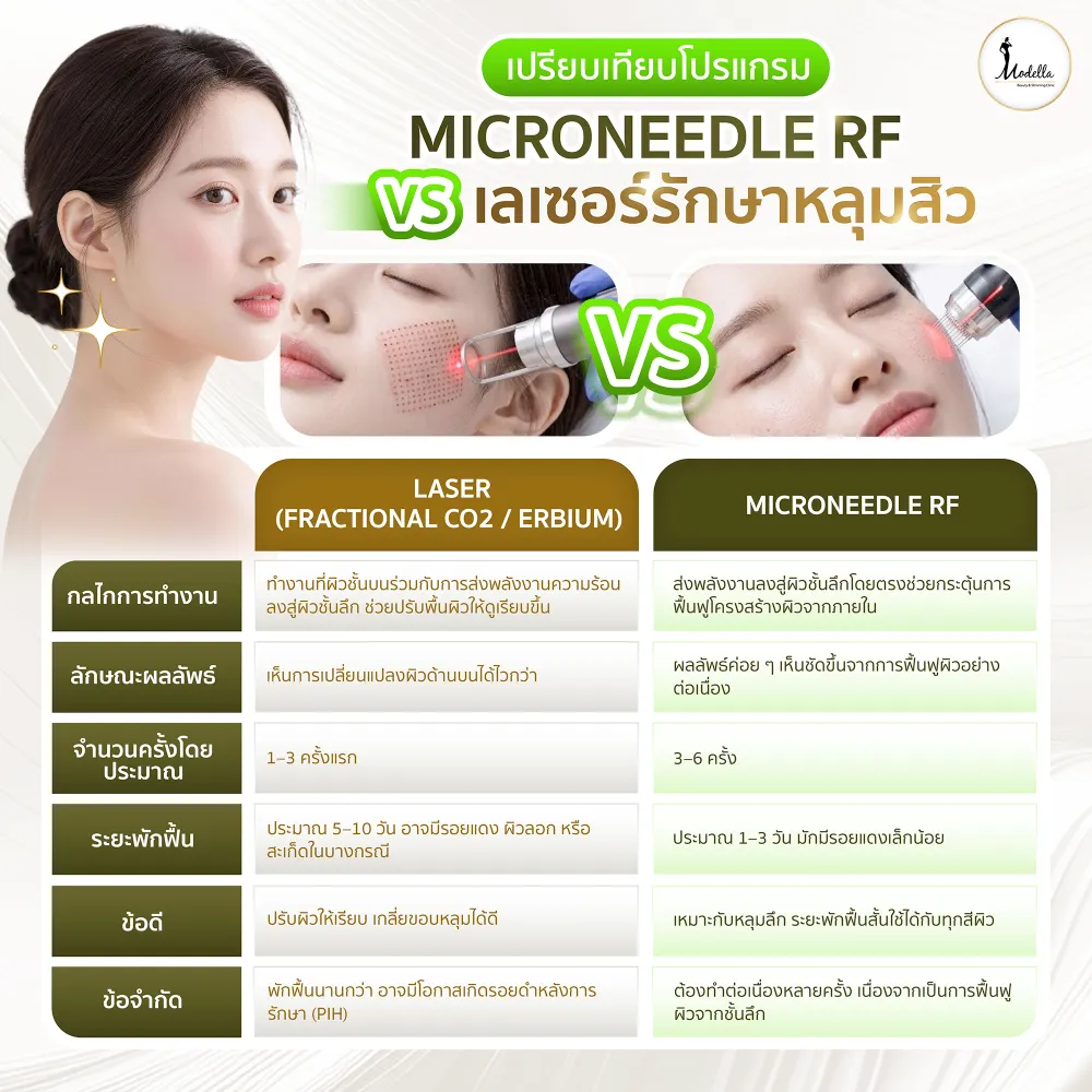 เปรียบเทียบโปรแกรม Microneedle RF vs เลเซอร์รักษาหลุมสิว