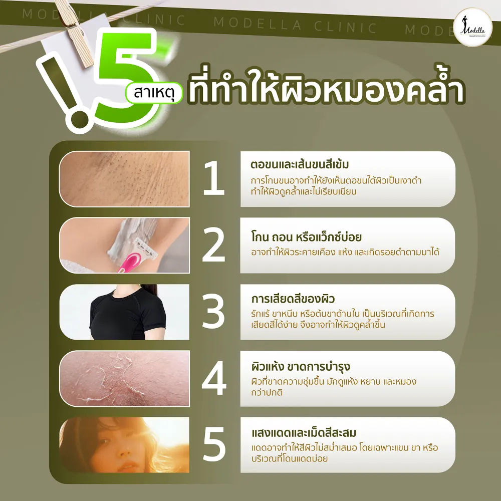 5 สาเหตุที่ทำให้ผิวหมองคล้ำ
