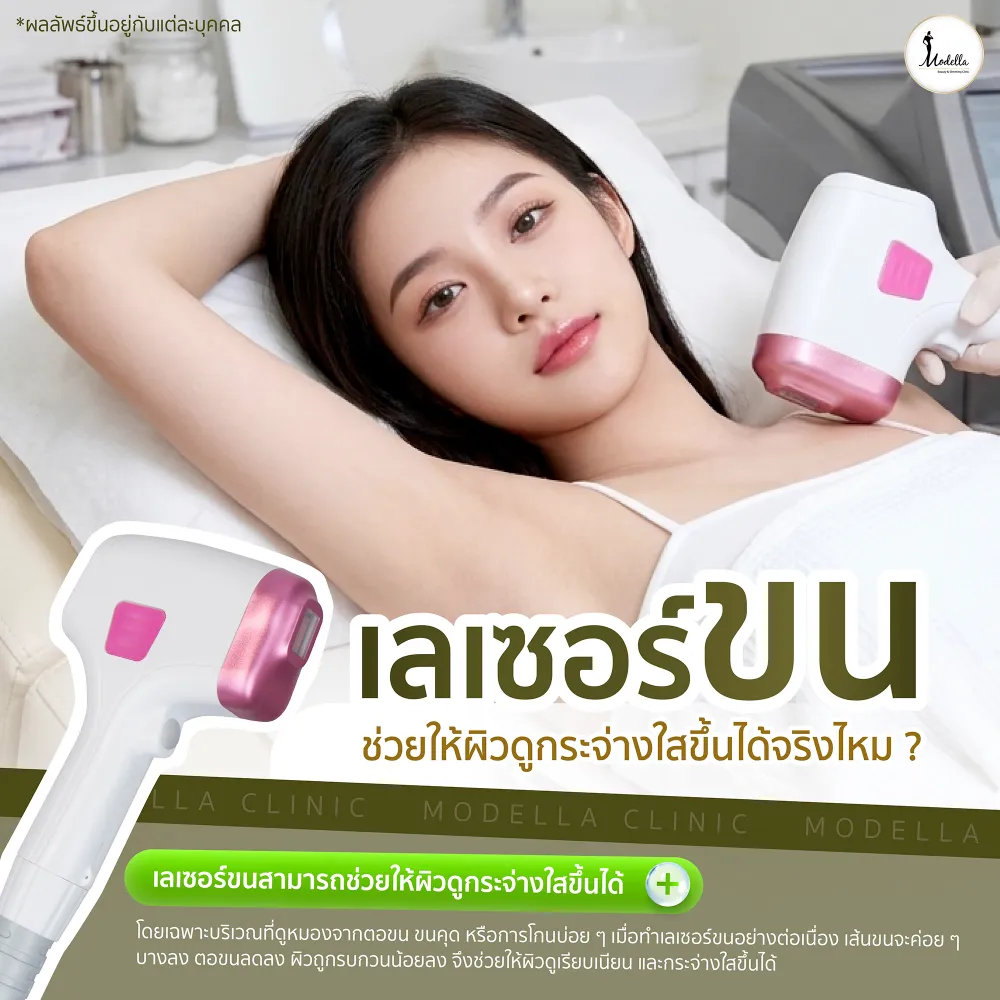 เลเซอร์ขน ช่วยให้ผิวดูกระจ่างใสขึ้นได้จริงไหม ? 