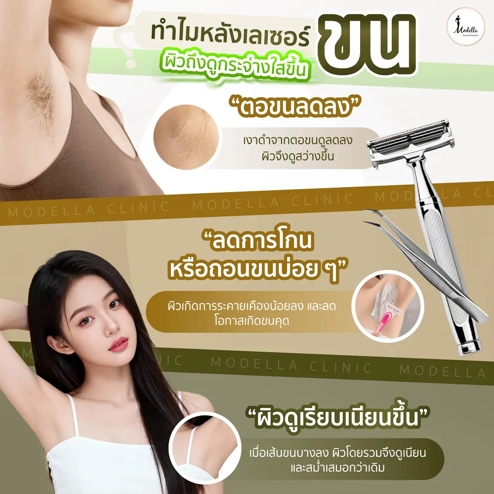 ทำไมหลังเลเซอร์ขน ผิวถึงดูใสขึ้น ? 