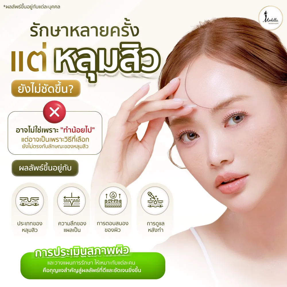ทำไมรักษาหลุมสิวหลายครั้ง แต่ผลลัพธ์ยังไม่ชัดขึ้น