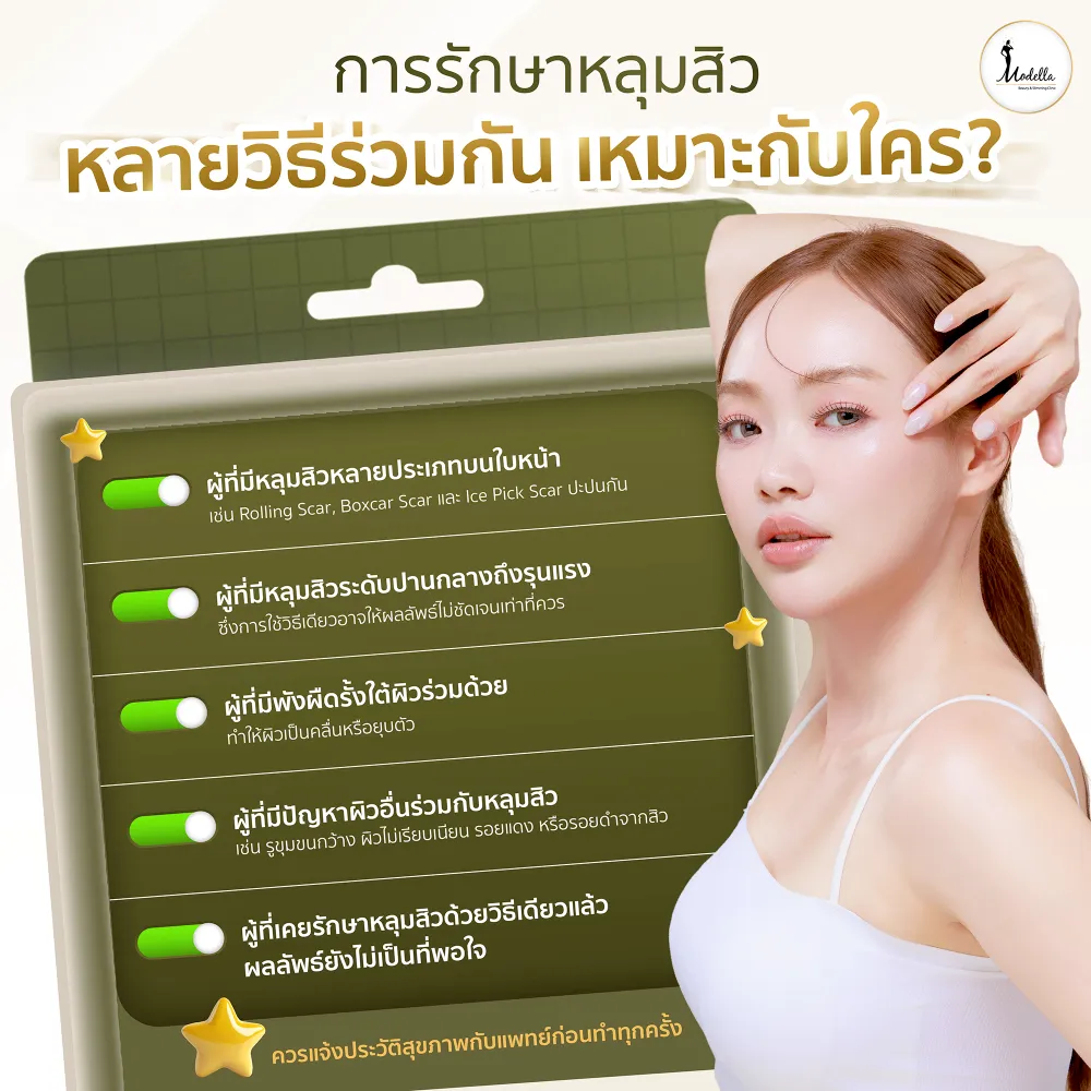 ใครเหมาะกับการรักษาหลุมสิวแบบหลายวิธีร่วมกัน