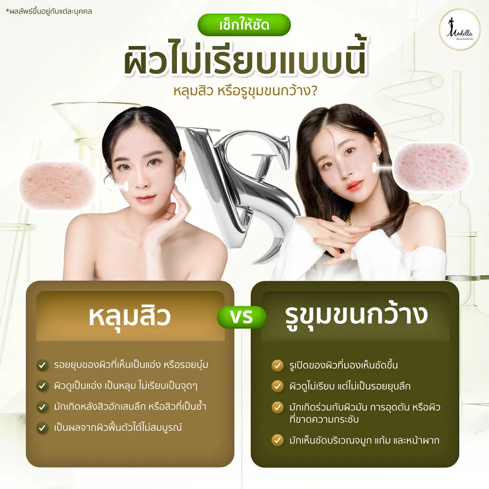 เช็กให้ชัดผิวไม่เรียบแบบนี้ หลุมสิวหรือรูขุมขนกว้าง?