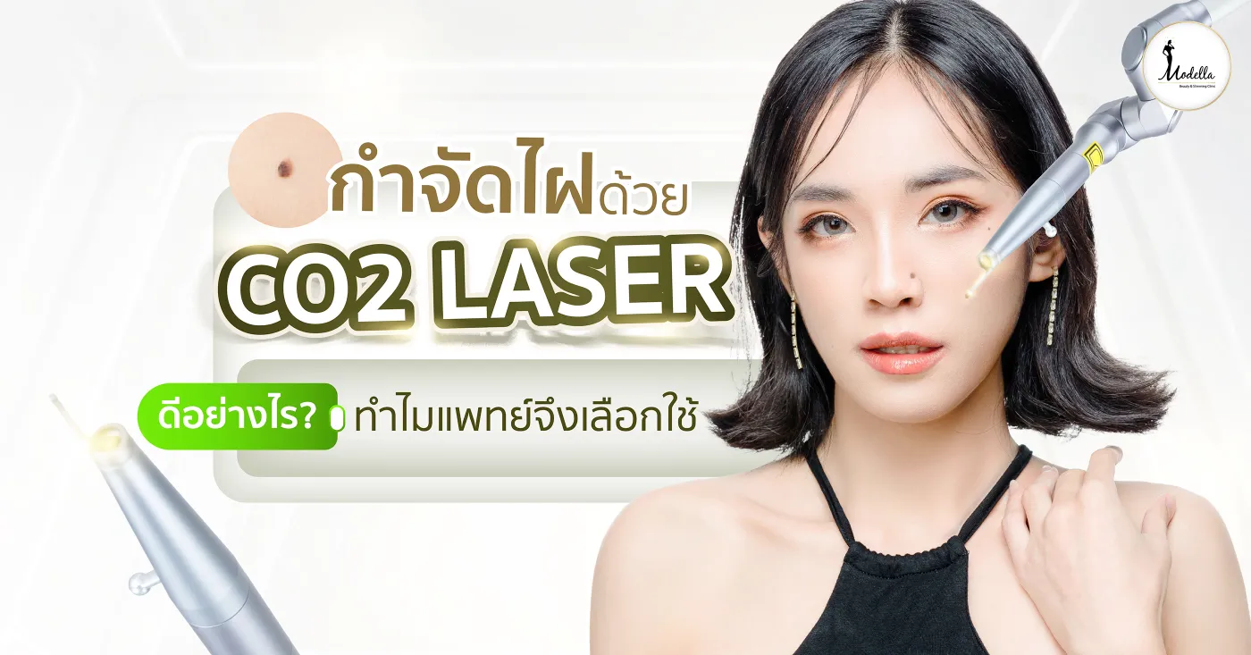 กำจัดไฝด้วย CO2 Laser ดีอย่างไร? ทำไมแพทย์จึงเลือกใช้